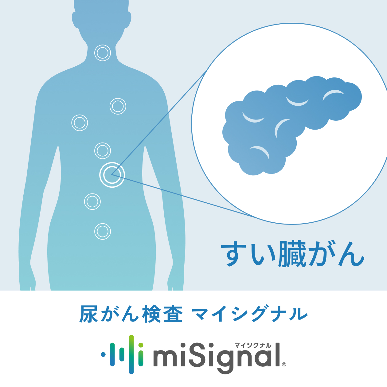 すい臓がんリスク検査 | がんリスク検査キット miSignal® (マイシグナル)